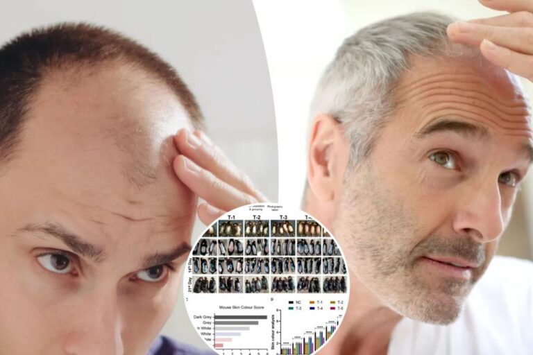 Breakthrough for baldness?  Sugar gel stimulates hair growth